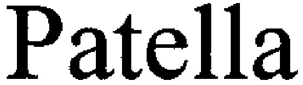 patella