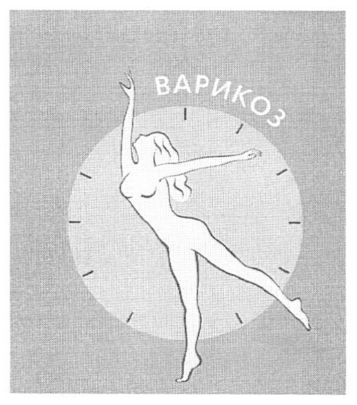 варикоз