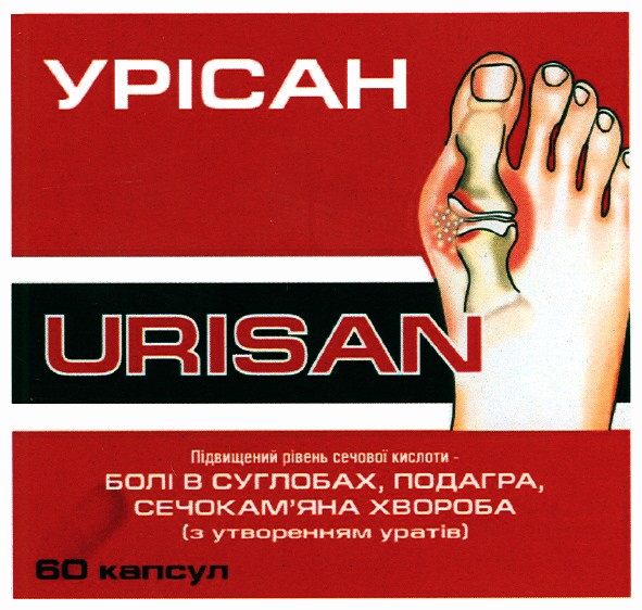 підвищений рівень сечової кислоти болі в суглобах, подагра, сечокам`яна хвороба (з утворенням уратів)