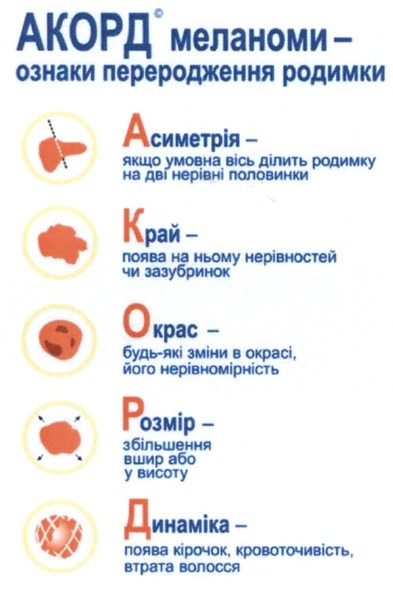 асиметрія - якщо умовна вісь ділить родимку на дві нерівні половинки
