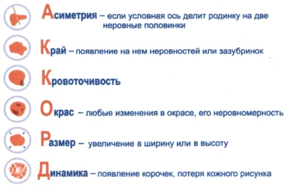 асиметрия - если условная ось делит родинку на две неровные половинки