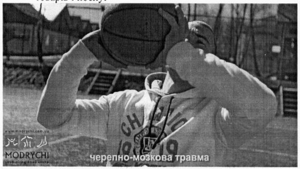 черепно-мозкова травма