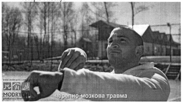 черепно-мозкова травма