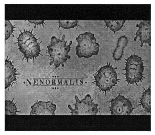 nenormalis