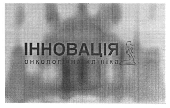інновація