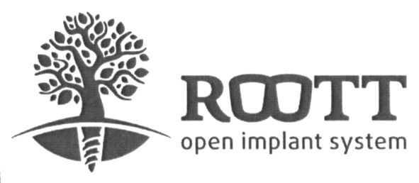 open implant system