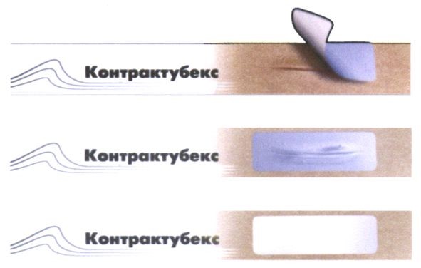 контрактубекс