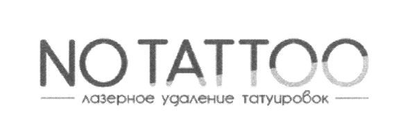 лазерное удаление татуировок