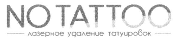 лазерное удаление татуировок