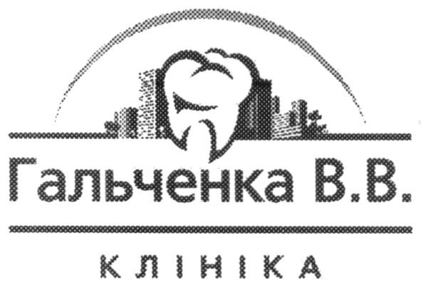 гальченка в.в.