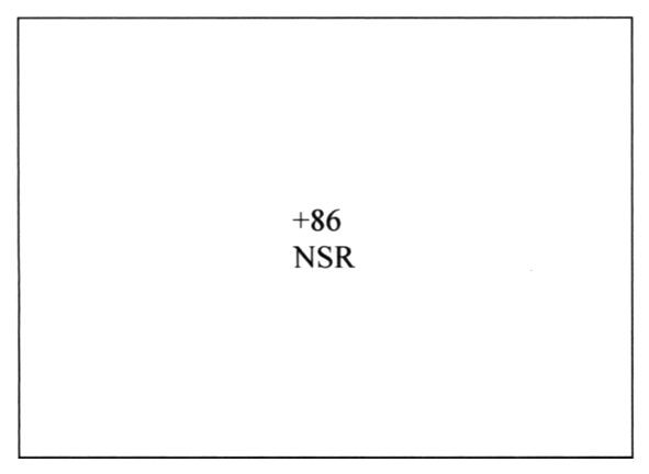+ 86 nsr
