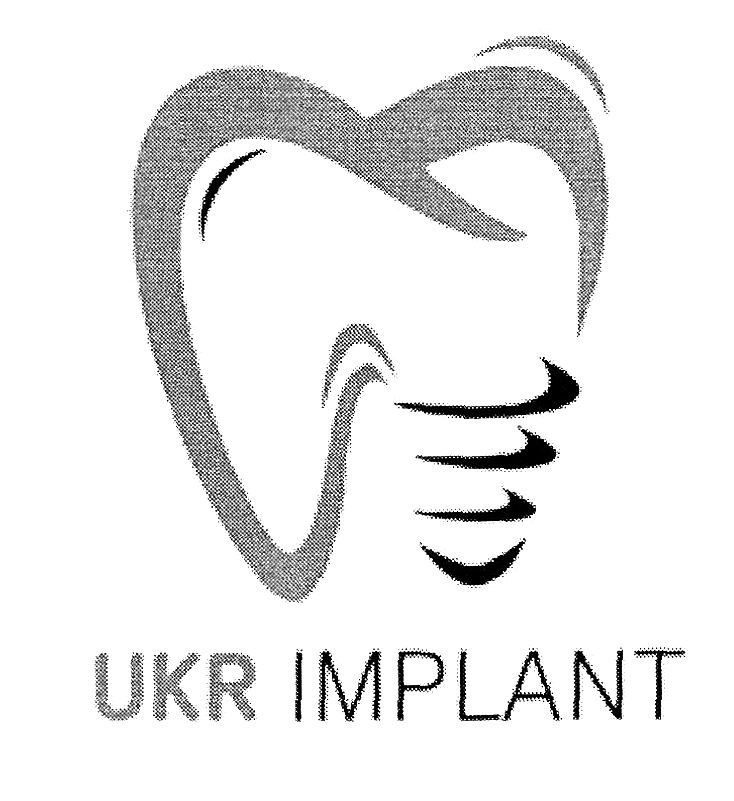 ukr implant