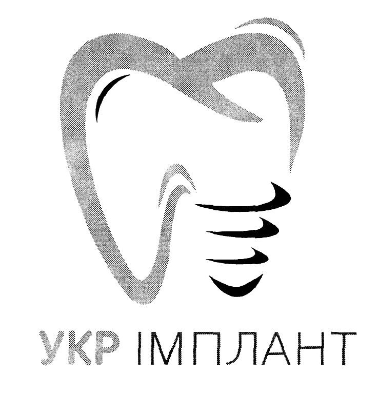 укр імплант