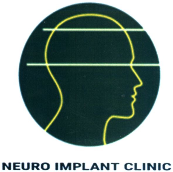 neuro implant clinic