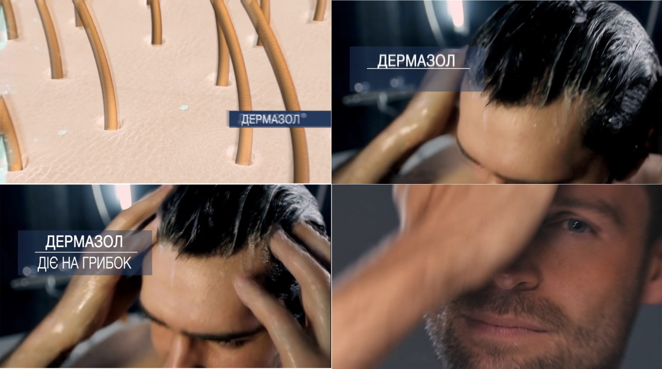 дермазол діє на грибок