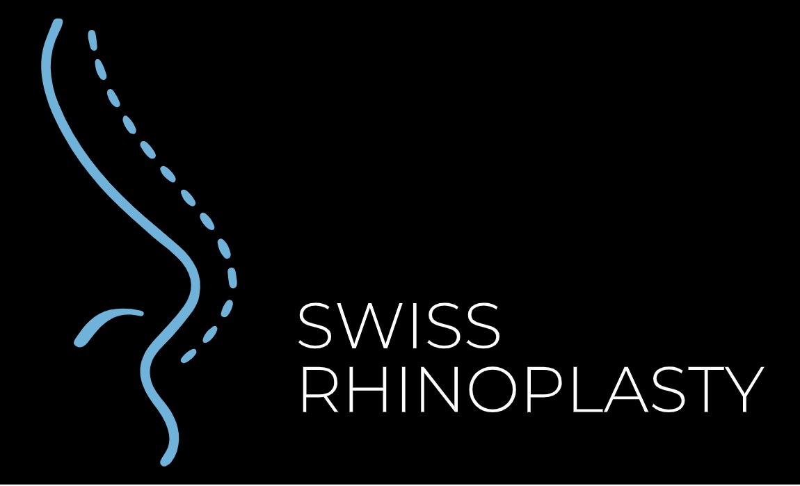 swiss rhinoplasty