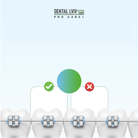 dental lviv